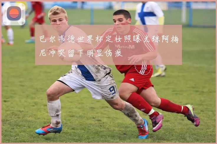 巴尔韦德世界杯定妆照曝光琼阿梅尼冲突留下明显伤痕